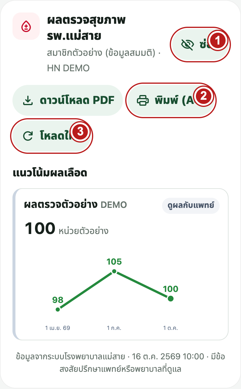 อ่านผลและจัดการการแสดงผล — หมายเลขบนภาพตรงกับขั้นตอนข้างภาพ